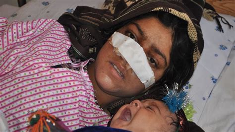Afghan Womans Nose Cut Off By Her Husband