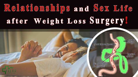 Does Bariatric Surgery Affect Your Sex Life Youtube