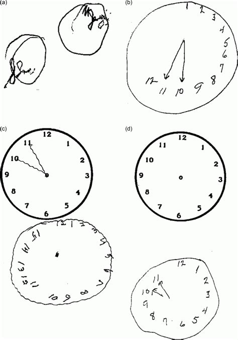 Clock Drawing Test Printable