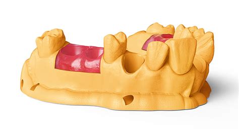 Nextdent Resin Cental Dental