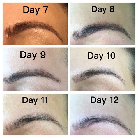 Microblading Healing Days 7 12 Oily Skin Day By Day Eyebrow