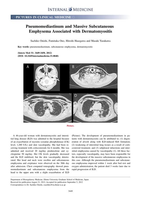 Pdf Pneumomediastinum And Massive Subcutaneous Emphysema Associated With Dermatomyositis