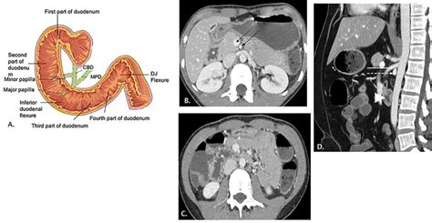 Anatomy Of Duodenum A Schematic Diagram Showing The Anatomy Of