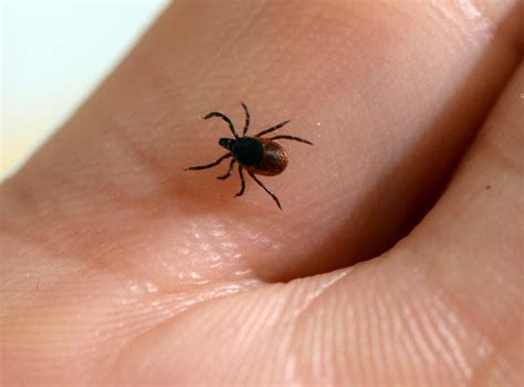 Babesiosis First Uk Case Of Deadly Tick Borne Disease Discovered In