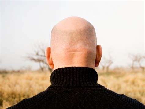 The Bald Truth How Author Nick Colemans Thinning Hair Made Him Heir