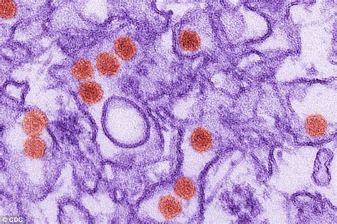 zika virus first sexually transmitted case is reported between gay couple cdc warns daily