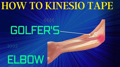 How To Treat Golfers Elbow Ulnar Nerve Using Kinesiology Tape Youtube