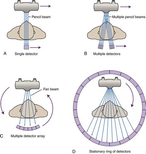 State machines as sequence detector. Computed Tomography | Radiology Key