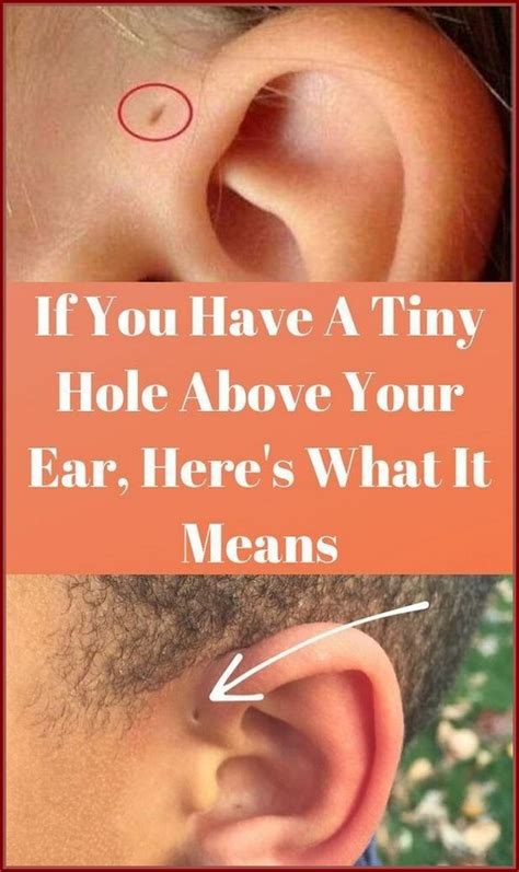 If You Have A Tiny Hole Above Your Ear Heres What It Means In 2022