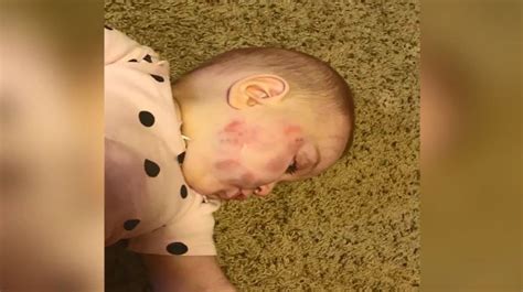 Montana Police Investigating After Infant Suffers Facial Bruising When
