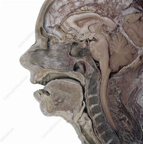 Sagittal Section Of Head Stock Image C0126770 Science Photo Library