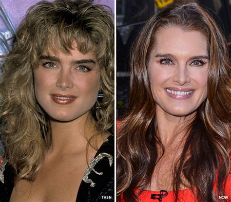 Brooke Shields Eyebrows And Makeover Sparse Eyelashes Face