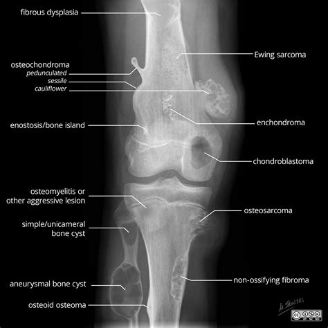 Diagram Of The Knee