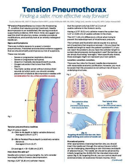 Tension Pneumothorax Needle Decompression