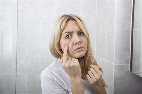 While the process might take longer in older children and adults, milia aren't. How Long Does It Take for a Pimple to Form? | Pimples ...