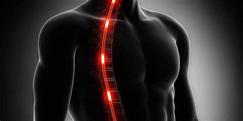 La sacralizzazione del vertebra l5 che cos è i sintomi le cause i