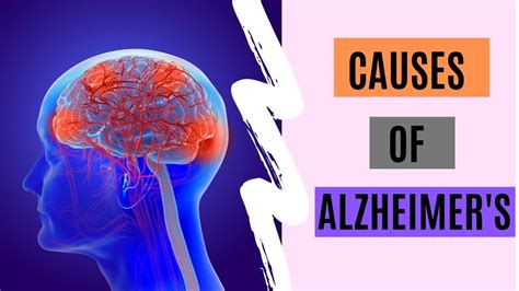 what are the causes of alzheimer s alzheimers alzheimer s disease senior care