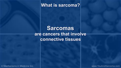 Understanding Soft Tissue Sarcoma