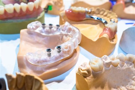 What Is Accelerated Orthodontics And Why You Should Know Dental Care