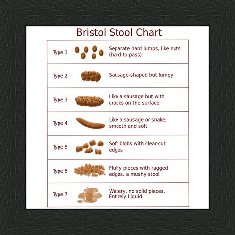 Bristol Stool Chart Reference Stools Item
