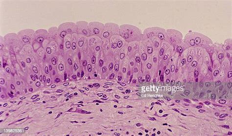 Transitional Epithelium Foto E Immagini Stock Getty Images