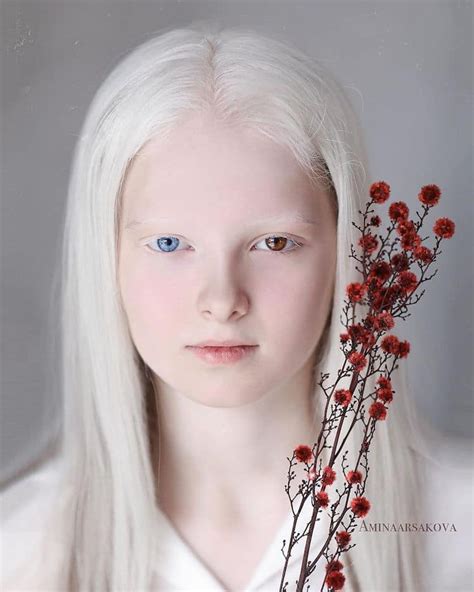 Beautiful Albino Girl Pussy