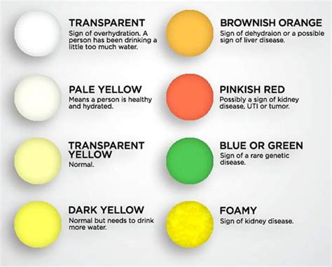 Urine Color Chart And Meaning Hubpages Urine Color Chart What Color What The Colour Of Your