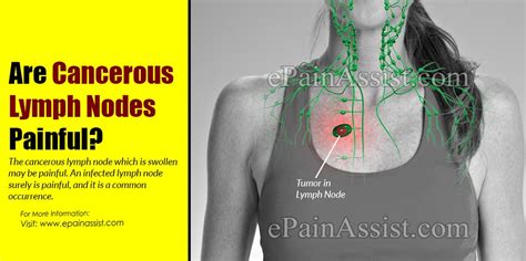 Are Cancerous Lymph Nodes Painful