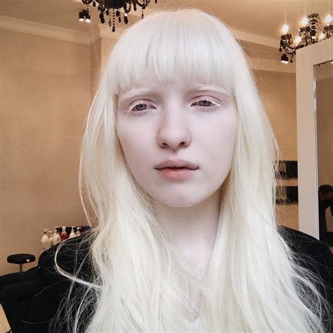 Pin By Verdure On Claire Nastya Kumarova Pale Beauty Albino Girl Pale Skin