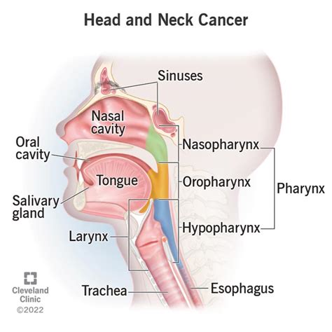 Understanding Head And Neck Cancers Types Treatments And Recovery