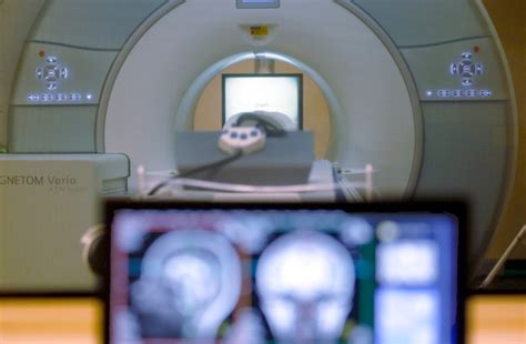 Male Vs Female Brain Big Study Of Mri Scans Concludes Thats Not A