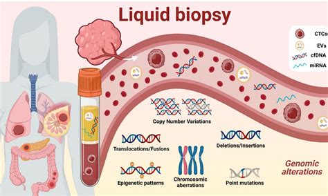 Liquid Biopsy Vs Traditional Biopsy Revolutionizing Cancer Detection