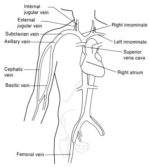 Central Venous Catheter Placement Procedure