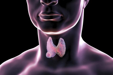 Genetic Test Helps Identify Benign Vs Malignant Thyroid Nodules