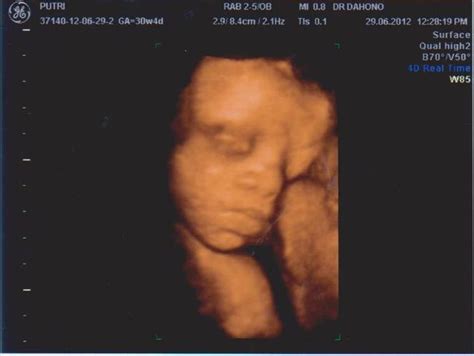 Hasil usg yang paling dominan terlihat adalah gambar janin. 4D kehamilan 7 bulan, dan Alhamdulillah 100% baby girl :) - IbuHamil.com