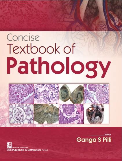 Concise Textbook Of Pathology Pb 20219789389688573 Pilli Gs