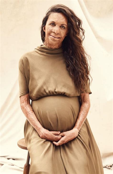 Turia Pitt Opens Up About Her Panic Amid The Bushfire Crisis News