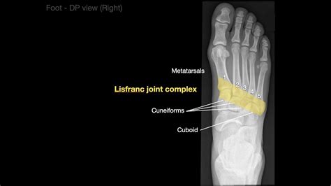 Normal foot and ankle x ray anatomy Anatomy of Foot X-rays - YouTube