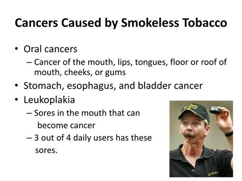 Ppt Smokeless Tobacco Powerpoint Presentation Free Download Id2016489