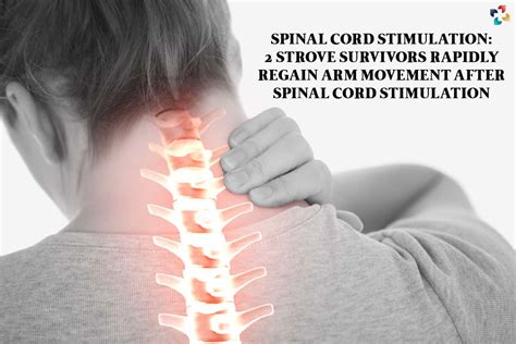 Spinal Cord Stimulation 2 Stroke Survivors Rapidly Regain Arm Movement