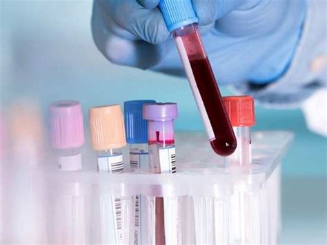 A team of scientists led by dr. Breast cancer relapse could be detected earlier with this ...
