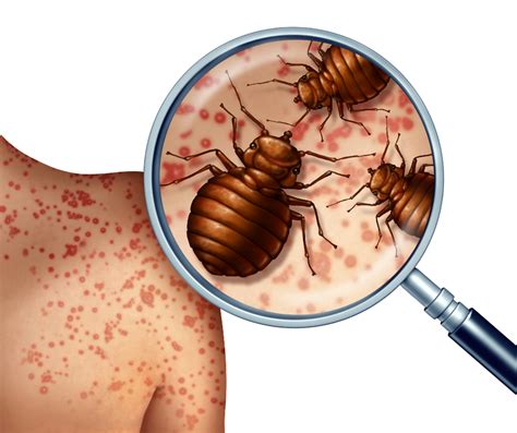 Do You Know The Warning Signs Of Bed Bug Infestation All N Pest Control Management LLC