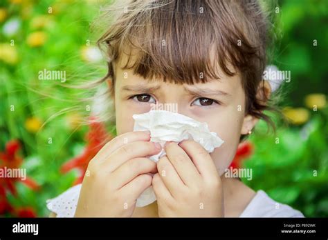 Seasonal Allergy In A Child Coryza Selective Focus Nature Stock