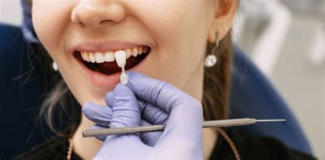 Dental Tooth Colored Filling Cost Ahmedabad Composite Fillings