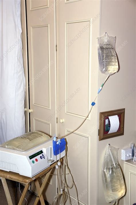 Peritoneal Dialysis At Home Stock Image C0151660 Science Photo
