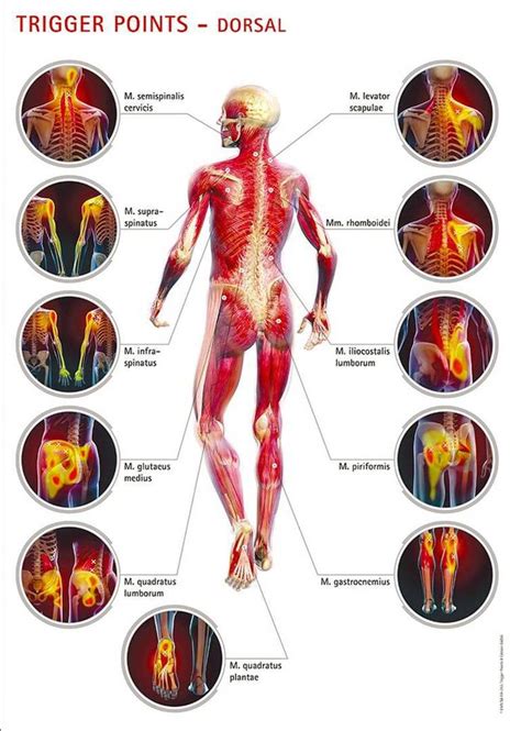 Back Muscle Pain Chart Infographics And Posters Real Bodywork The