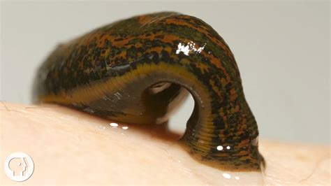 Take Two Leeches And Call Me In The Morning Deep Look Kqed Science