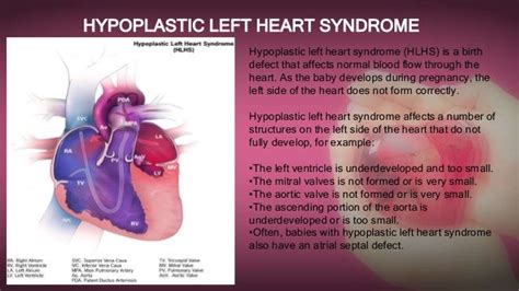 Critical Congenital Heart Diseases