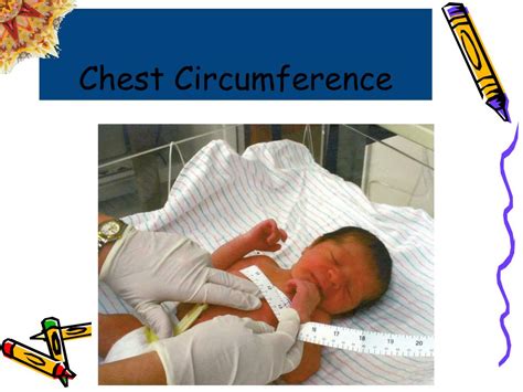 Ppt The Newborn Physical Exam Powerpoint Presentation Free Download