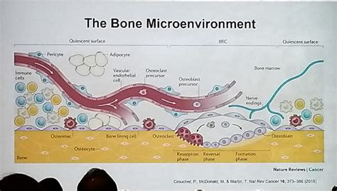 Bone Marrow Microenvironment Moves Forward HealthTree For Multiple Myeloma